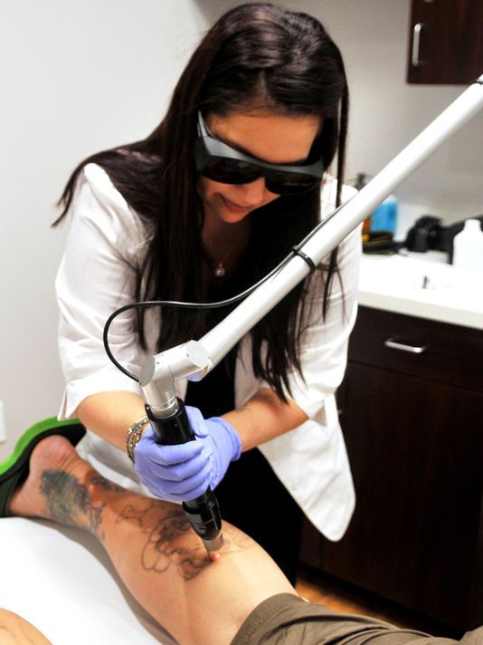 Breaking Free from the Past: The Evolution of Tattoo Removal Techniques.