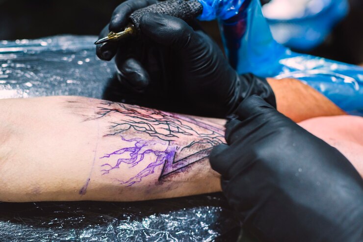 Emerging Technologies In Tattoo Removal: Advancements And Future Directions