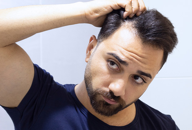 Step-by-Step Guide to Treating Hair Loss in Beta 1.